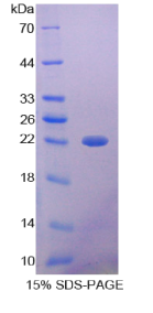 α1-微球蛋白(α1M)重组蛋白