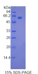 低密度脂蛋白受体相关蛋白8(LRP8)重组蛋白