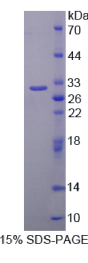ISL LIM同源框蛋白1(ISL1)重组蛋白
