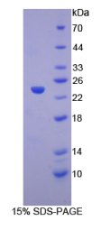 T-细胞激活连接蛋白家族成员2(LAT2)重组蛋白