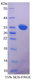 AMP激活蛋白激酶α1(PRKAα1)重组蛋白