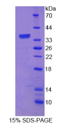 淀粉样蛋白β前体蛋白结合蛋白B3(APBB3)重组蛋白