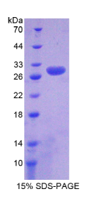非ATP酶蛋白酶体26S亚基9(PSMD9)重组蛋白