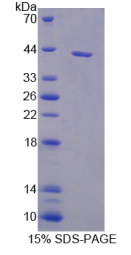 白介素11受体α(IL11Rα)重组蛋白