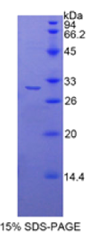 组蛋白脱乙酰基酶6(HDAC6)重组蛋白