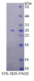 Metaxin 1蛋白(MTX1)重组蛋白