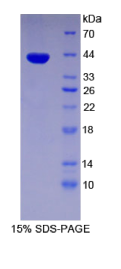Pygopus同源物1(PYGO1)重组蛋白