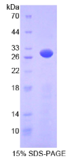 AMP激活蛋白激酶γ2(PRKAγ2)重组蛋白