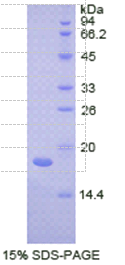 沉默调节蛋白7(SIRT7)重组蛋白