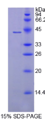 补体成分8β(C8β)重组蛋白