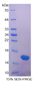 半乳糖凝集素1(GAL1)重组蛋白