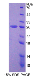 非ATP酶蛋白酶体26S亚基5(PSMD5)重组蛋白