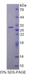 SRSF蛋白激酶2(SKL2)重组蛋白