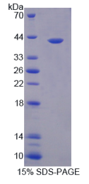 多聚ADP核糖聚合酶4(PARP4)重组蛋白