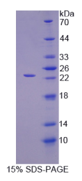 白介素1α(IL1α)重组蛋白