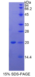 白介素1β(IL1β)重组蛋白