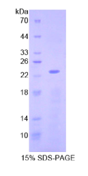 非转移细胞3表达NM23A蛋白(NME3)重组蛋白