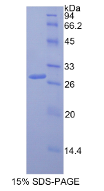 多聚蛋白1(MMRN1)重组蛋白