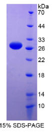 RNA结合基元蛋白38(RBM38)重组蛋白