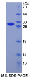 半胱氨酸丰富分泌蛋白1(CRISP1)重组蛋白