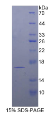 T-细胞白血病淋巴瘤蛋白1A(TCL1A)重组蛋白