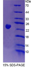 Vav3癌基因(VAV3)重组蛋白