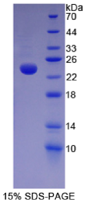 α1-酸性糖蛋白(α1AGP)重组蛋白
