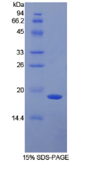 α2-纤溶酶抑制因子(α2PI)重组蛋白