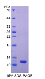 雌激素受体β(ERβ)重组蛋白