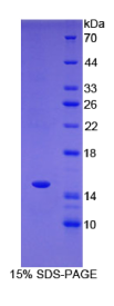 T-框蛋白3(TBX3)重组蛋白