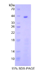 补体成分8β(C8β)重组蛋白