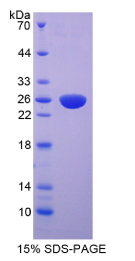 成纤维细胞生长因子受体4(FGFR4)重组蛋白