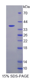 半乳糖凝集素4(GAL4)重组蛋白