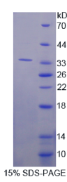 Ras抑制蛋白1(RSU1)重组蛋白