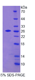 淀粉样蛋白β前体样蛋白2(APLP2)重组蛋白