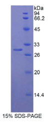 Mindbomb同源物1(MIB1)重组蛋白
