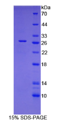 WNT1诱导信号通道蛋白2(WISP2)重组蛋白