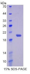 白介素17受体B(IL17RB)重组蛋白