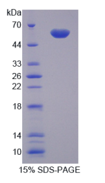组织蛋白酶G(CTSG)重组蛋白