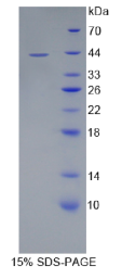 CD4分子(CD4)重组蛋白