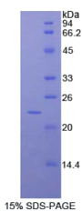 RAD54样蛋白2(RAD54L2)重组蛋白