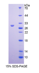 多配体蛋白聚糖1(SDC1)重组蛋白