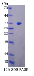 Zuotin相关因子1(ZRF1)重组蛋白