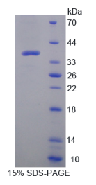 防御素α2(DEFα2)重组蛋白