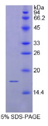 CD72分子(CD72)重组蛋白