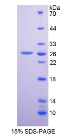 二肽基肽酶6(DPP6)重组蛋白