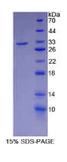 Smad同源物6(Smad6)重组蛋白