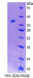 白介素2受体α(IL2Rα)重组蛋白