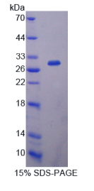 白介素2受体α(IL2Rα)重组蛋白