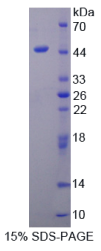 Mg2+/Mn2+依赖性蛋白磷酸酶1A(PPM1A)重组蛋白